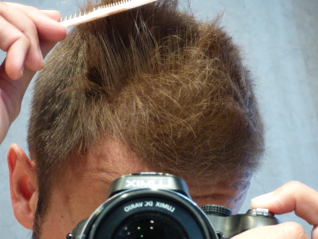 La moda: fibras capilares para la caída del cabello